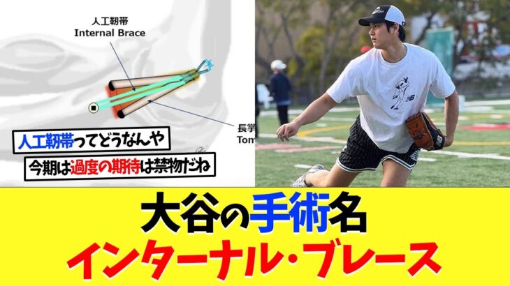 大谷翔平の執刀医が肘手術について語り【海外の反応】【大谷翔平】【なんｊ】【2ch】【プロ野球】【甲子園】【MLB】