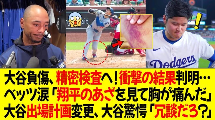 大谷が負傷、精密検査を受け、衝撃の結果が判明… ! ベッツ、初めて涙「翔平のあざを見て胸が痛んだ」詳細写真公開 ! 大谷の出場計画が変更、大谷驚愕「冗談だろ？」