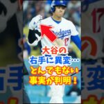 大谷翔平、右手の異変にとんでもない事実が発覚！
