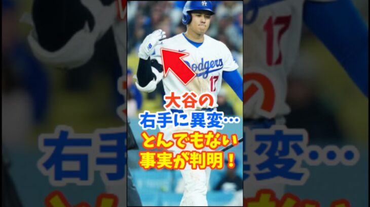 大谷翔平、右手の異変にとんでもない事実が発覚！