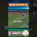 【緊急事態】大谷翔平の指が出血…4回完璧から一転4失点 #野球#mlb