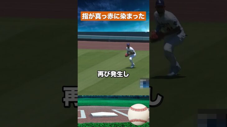 【緊急事態】大谷翔平の指が出血…4回完璧から一転4失点 #野球#mlb