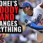 Should Shohei Ohtani take a break from Pitching?