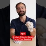Shohei Ohtani’s Blood is on This Baseball